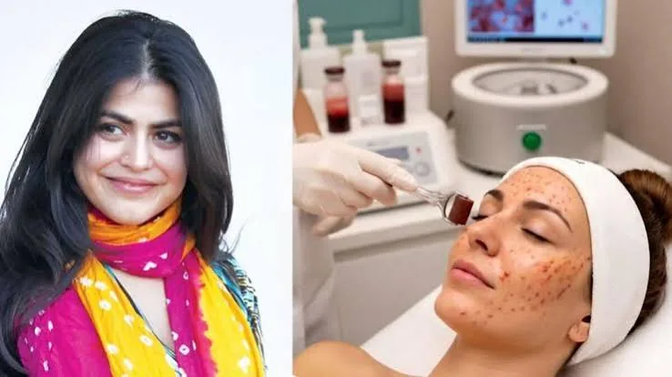वायरल ब्यूटी सीक्रेट: शहनाज ट्रेजरी ने दिखाया वैम्पायर फेशियल का पूरा तरीका, किम कार्दशियन और शाहरुख खान हैं इसके बड़े फैन