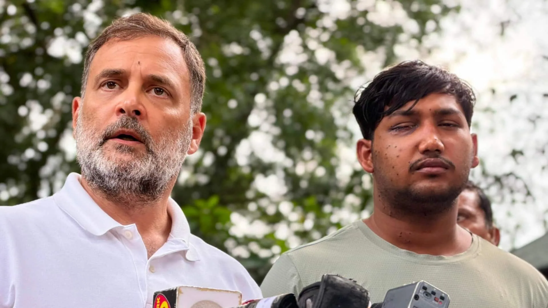 राजनीतिक घमासान: पैलेट गन के छर्रों और राहुल गांधी के बयानों पर गरमाई सियासत