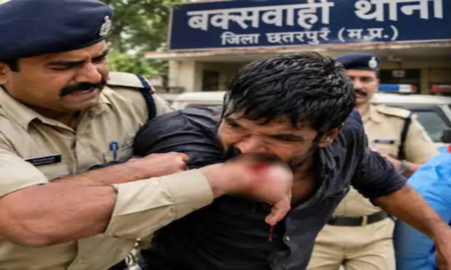 गिरफ्तार करने गए आरोपी को कांस्टेबल ने काटा, मेडिकल जांच में वह HIV संक्रमित निकला