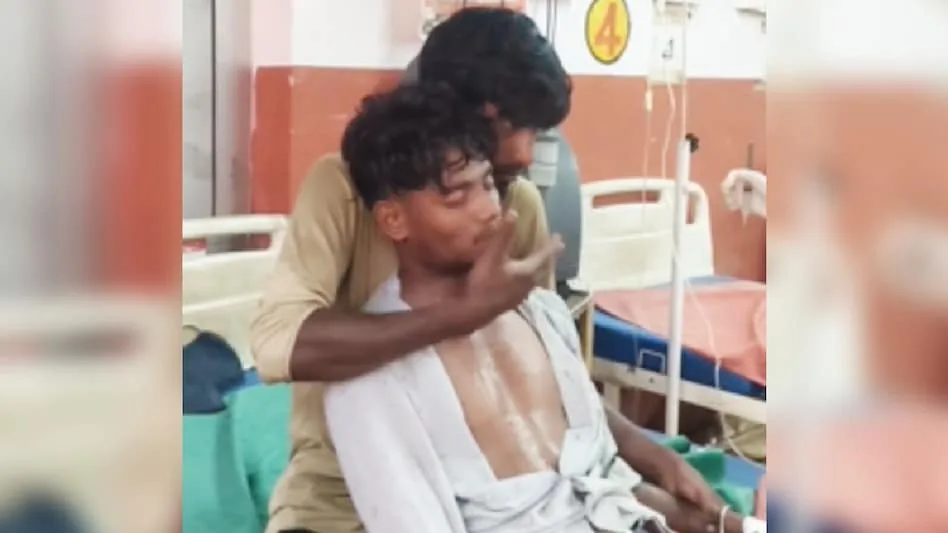 हरदोई में अनूठी घटना: भाई को मारे 150 थप्पड़ और बच गई जान